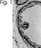 Estrogen Receptor 1 antibody, PA1-309, Invitrogen Antibodies, Immunohistochemistry frozen image 