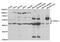 CDK5 Regulatory Subunit Associated Protein 1 Like 1 antibody, MBS2527645, MyBioSource, Western Blot image 