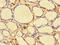 Debranching RNA Lariats 1 antibody, LS-C677649, Lifespan Biosciences, Immunohistochemistry paraffin image 
