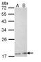 Phospholipase A2 Group XIIA antibody, NBP1-31693, Novus Biologicals, Western Blot image 