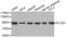 Procollagen-Lysine,2-Oxoglutarate 5-Dioxygenase 3 antibody, LS-C332035, Lifespan Biosciences, Western Blot image 