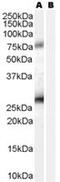 Estrogen Receptor Binding Site Associated Antigen 9 antibody, MBS420604, MyBioSource, Western Blot image 