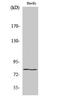 Homeodomain Interacting Protein Kinase 4 antibody, STJ93502, St John