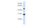 Proteasome 26S Subunit, ATPase 3 antibody, 27-143, ProSci, Enzyme Linked Immunosorbent Assay image 