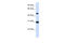26S protease regulatory subunit 6A antibody, 27-143, ProSci, Enzyme Linked Immunosorbent Assay image 