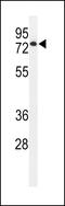 Ectonucleotide Pyrophosphatase/Phosphodiesterase 7 antibody, 61-716, ProSci, Western Blot image 