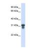 Solute Carrier Family 25 Member 11 antibody, NBP1-59597, Novus Biologicals, Western Blot image 