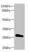 Claudin 18 antibody, LS-C675543, Lifespan Biosciences, Western Blot image 