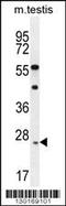 Rhophilin Associated Tail Protein 1 Like antibody, 56-072, ProSci, Western Blot image 
