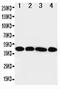 Interleukin 3 Receptor Subunit Alpha antibody, LS-C312772, Lifespan Biosciences, Western Blot image 