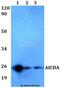 Activation Induced Cytidine Deaminase antibody, LS-C411728, Lifespan Biosciences, Western Blot image 