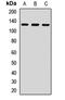 Zinc Finger E-Box Binding Homeobox 1 antibody, LS-C667943, Lifespan Biosciences, Western Blot image 