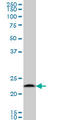 Proteasome Subunit Beta 6 antibody, LS-C133415, Lifespan Biosciences, Western Blot image 