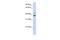 Makorin Ring Finger Protein 2 antibody, A10562, Boster Biological Technology, Western Blot image 