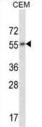 Cholinergic Receptor Muscarinic 2 antibody, abx028043, Abbexa, Western Blot image 