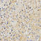 Amyloid Beta Precursor Like Protein 2 antibody, LS-C334068, Lifespan Biosciences, Immunohistochemistry paraffin image 