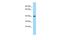 Carbohydrate Sulfotransferase 11 antibody, PA5-69475, Invitrogen Antibodies, Western Blot image 