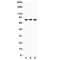 Transient Receptor Potential Cation Channel Subfamily V Member 6 antibody, R31086, NSJ Bioreagents, Western Blot image 