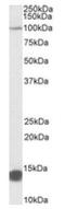 Tripartite Motif Containing 71 antibody, AP23732PU-N, Origene, Western Blot image 