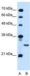 Podoplanin antibody, TA335682, Origene, Western Blot image 