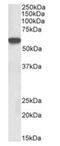 LCK Proto-Oncogene, Src Family Tyrosine Kinase antibody, orb12375, Biorbyt, Western Blot image 