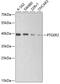 Prostaglandin E Receptor 2 antibody, GTX65914, GeneTex, Western Blot image 
