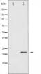 Protein Phosphatase 1 Regulatory Inhibitor Subunit 14A antibody, abx011370, Abbexa, Western Blot image 