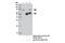 Spleen Associated Tyrosine Kinase antibody, 12358S, Cell Signaling Technology, Immunoprecipitation image 