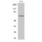 Heterogeneous Nuclear Ribonucleoprotein L antibody, LS-C383988, Lifespan Biosciences, Western Blot image 