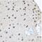 CCCTC-Binding Factor antibody, GTX32541, GeneTex, Immunohistochemistry paraffin image 