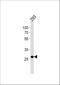 Proline Rich Protein BstNI Subfamily 4 antibody, A11033, Boster Biological Technology, Western Blot image 