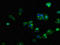 C-X-C chemokine receptor type 5 antibody, LS-C669810, Lifespan Biosciences, Immunofluorescence image 