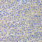 Signal Transducer And Activator Of Transcription 4 antibody, LS-C346178, Lifespan Biosciences, Immunohistochemistry paraffin image 