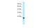 TNF Receptor Superfamily Member 18 antibody, PA5-46810, Invitrogen Antibodies, Western Blot image 