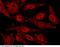 Kelch Like ECH Associated Protein 1 antibody, 101205-T10, Sino Biological, Immunohistochemistry paraffin image 