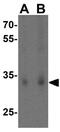 SCO Cytochrome C Oxidase Assembly Protein 2 antibody, GTX85482, GeneTex, Western Blot image 