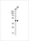 Adenosine Deaminase antibody, 55-962, ProSci, Western Blot image 