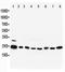 RAB5A, Member RAS Oncogene Family antibody, PA1773, Boster Biological Technology, Western Blot image 