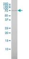 ATP Binding Cassette Subfamily F Member 2 antibody, H00010061-M01, Novus Biologicals, Western Blot image 