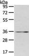 Caudal Type Homeobox 2 antibody, CSB-PA559486, Cusabio, Western Blot image 