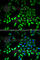 Pyruvate Kinase M1/2 antibody, A0268, ABclonal Technology, Immunofluorescence image 