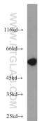 Peripherin antibody, 17399-1-AP, Proteintech Group, Western Blot image 