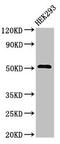 TNF Receptor Superfamily Member 10a antibody, CSB-PA023964LA01HU, Cusabio, Western Blot image 