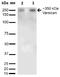 Versican antibody, NBP2-22408, Novus Biologicals, Western Blot image 