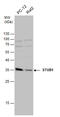 E3 ubiquitin-protein ligase CHIP antibody, GTX122827, GeneTex, Western Blot image 