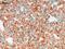 Carbamoyl-Phosphate Synthase 1 antibody, ab3682, Abcam, Immunohistochemistry paraffin image 