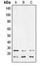 Transforming Growth Factor Beta 3 antibody, MBS822335, MyBioSource, Western Blot image 