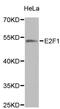 E2F-1 antibody, MBS126416, MyBioSource, Western Blot image 