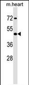 Homeobox A2 antibody, PA5-71990, Invitrogen Antibodies, Western Blot image 