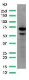Alpha Fetoprotein antibody, MA5-16321, Invitrogen Antibodies, Western Blot image 
